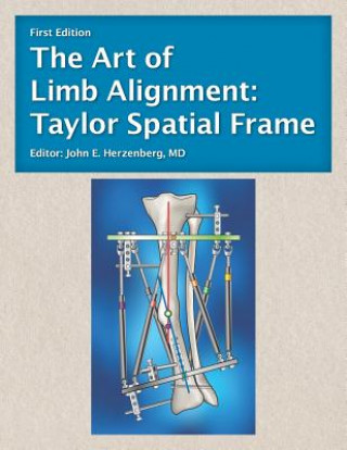 Carte The Art of Limb Alignment: Taylor Spatial Frame John E Herzenberg
