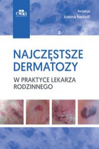 Książka Najczęstsze dermatozy w praktyce lekarza rodzinnego 