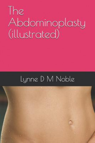 Knjiga The Abdominoplasty (Illustrated) Lynne D M Noble