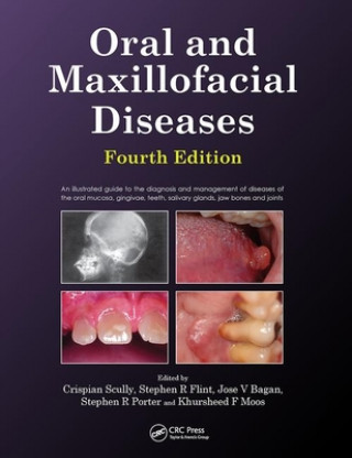 Kniha Oral and Maxillofacial Diseases, Fourth Edition Stephen Flint