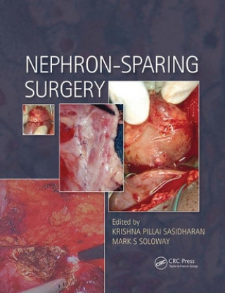 Knjiga Nephron-Sparing Surgery Krishna Sasidharan