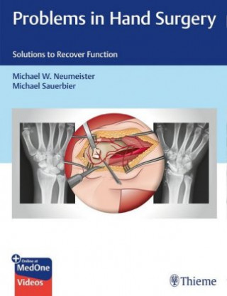Kniha Problems in Hand Surgery Michael Sauerbier