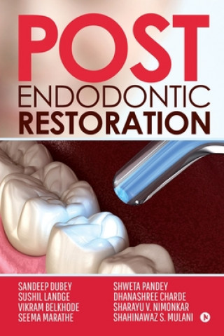 Kniha Post Endodontic Restoration Sushil Landge