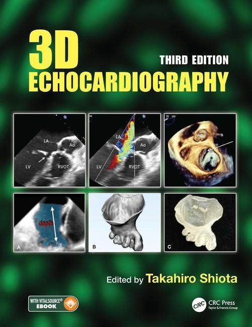 Kniha 3D Echocardiography 