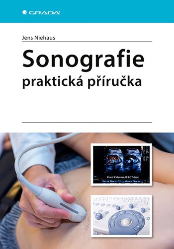 Book Sonografie - praktická příručka Jens Niehaus