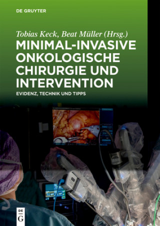 Kniha Minimal-invasive Onkologische Chirurgie und Intervention Tobias Keck