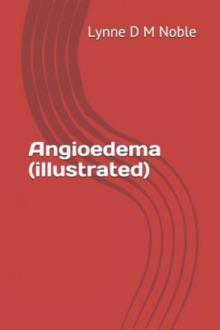 Könyv Angioedema (Illustrated) Lynne D M Noble