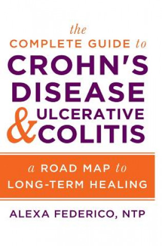 Könyv The Complete Guide to Crohn's Disease & Ulcerative Colitis: A Road Map to Long-Term Healing Alexa Federico