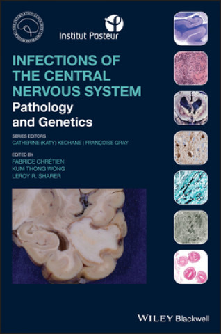 Knjiga Infections of the Central Nervous System - Pathology and Genetics Fabrice Chretien