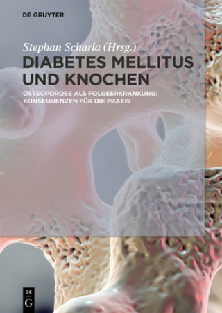 Buch Diabetes Mellitus und Knochen Stephan Scharla