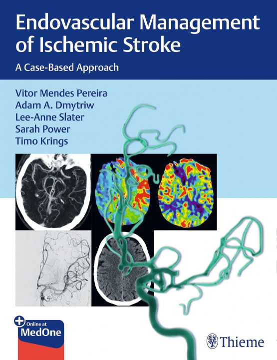Kniha Endovascular Management of Ischemic Stroke Lee-Ann Slater