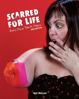 Książka Scarred for Life. 2nd Edition Ted Meyer