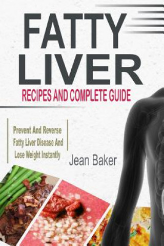 Buch Fatty Liver: Recipes and Complete Guide to Prevent and Reverse Fatty Liver Disease and Lose Weight Instantly Jean Baker