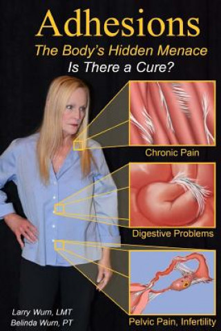 Carte Adhesions: The Body's Inner Menace - Is There a Cure? Larry Wurn Lmt