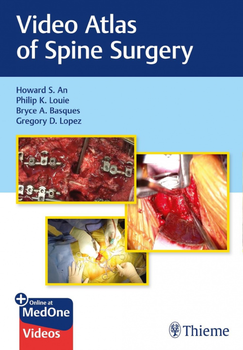 Kniha Video Atlas of Spine Surgery Howard An