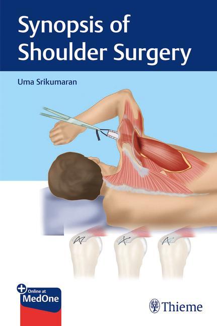 Könyv Synopsis of Shoulder Surgery 