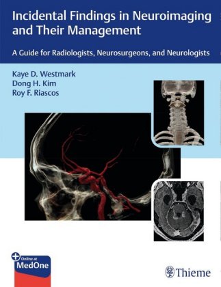 Livre Incidental Findings in Neuroimaging and Their Management Kaye Westmark