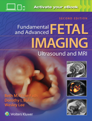 Kniha Fundamental and Advanced Fetal Imaging Ultrasound and MRI Kline-Fath