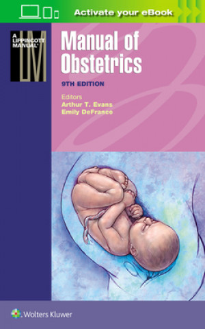 Buch Manual of Obstetrics Arthur T. Evans