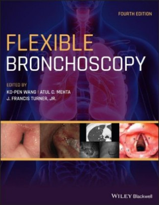Kniha Flexible Bronchoscopy 4e WANG