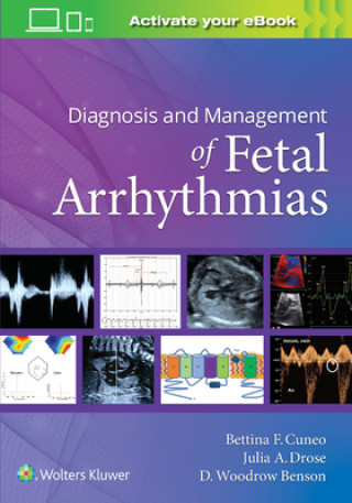 Könyv Diagnosis and Management of Fetal Arrhythmias 