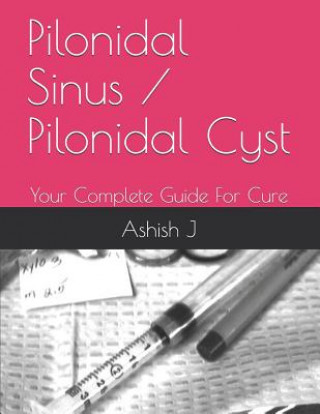 Könyv Pilonidal Sinus / Pilonidal Cyst: Your Complete Guide For Cure Bhumika J
