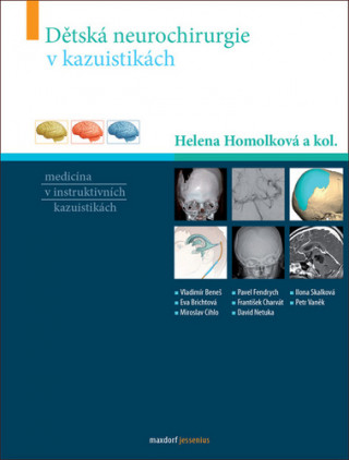 Könyv Dětská neurochirurgie v kazuistikách Helena Homolková a kol.