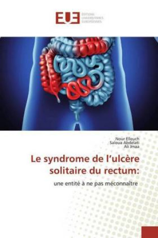 Βιβλίο syndrome de l'ulcere solitaire du rectum Saloua Abdelati