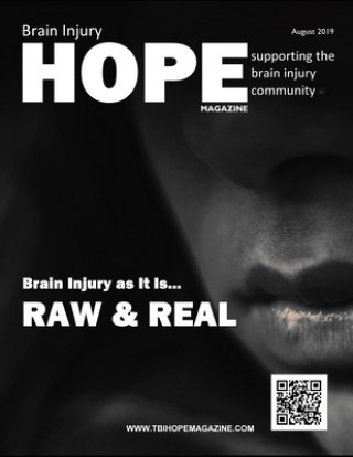 Kniha Brain Injury Hope Magazine - August 2019 Sarah Grant