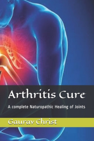 Carte Arthritis Cure: A complete Naturopathic Healing of Joints Gaurav Christ