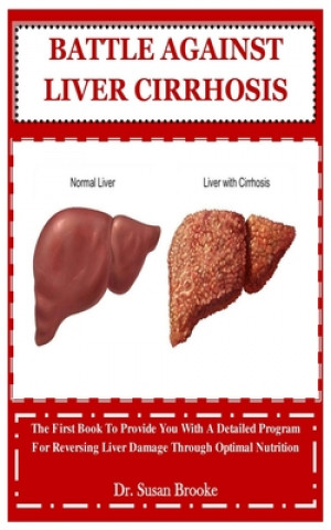 Carte Battle Against Liver Cirrhosis: The First Book To Provide You With A Detailed Program For Reversing Liver Damage Through Optimal Nutrition Susan Brooke
