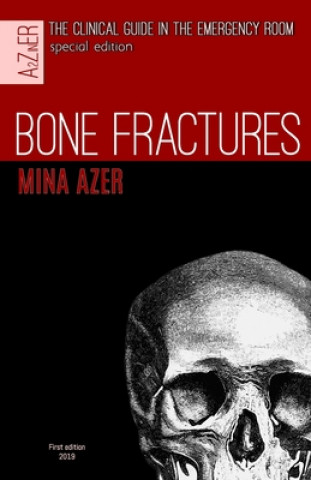 Carte Bone Fractures: special edition of the clinical guide in the Emergency room. Mina Azer