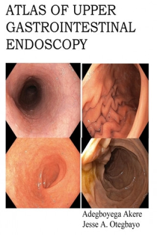 Könyv Atlas of Upper Gastrointestinal Endoscopy Jesse Abiodun Otegbayo