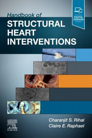 Knjiga Handbook of Structural Heart Interventions Rihal