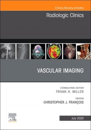Kniha Vascular Imaging, An Issue of Radiologic Clinics of North America Francois
