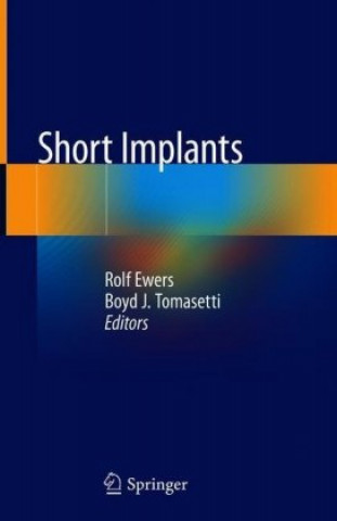 Knjiga Short Implants Rolf Ewers