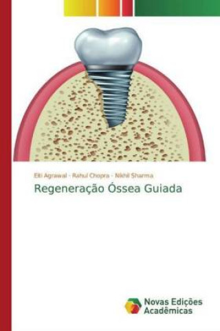 Book Regeneraç?o Óssea Guiada Rahul Chopra