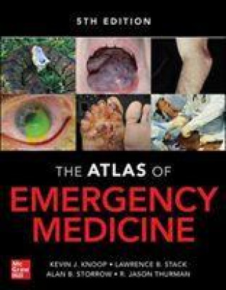 Книга Atlas of Emergency Medicine Kevin J. Knoop