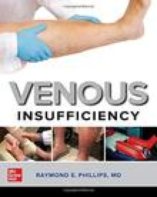 Knjiga Venous Insufficiency Phillips