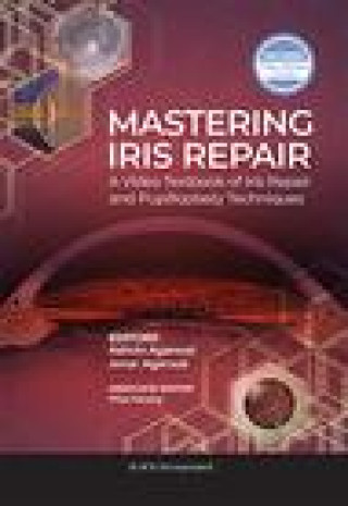 Buch Mastering Iris Repair Ashvin Agarwal