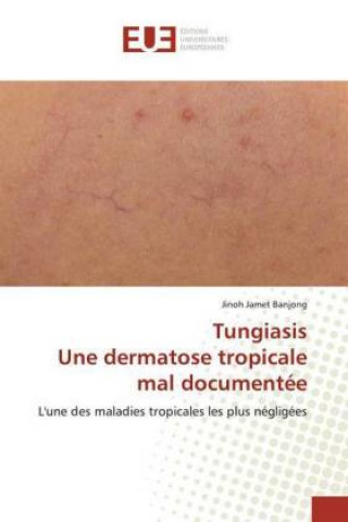 Könyv TungiasisUne dermatose tropicale mal documentée 