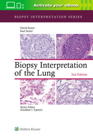 Könyv Biopsy Interpretation of the Lung Saul Suster