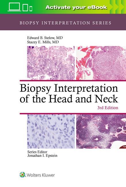 Kniha Biopsy Interpretation of the Head and Neck Stelow & Mills