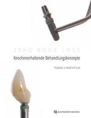 Книга Zero Bone Loss: Knochenerhaltende Behandlungskonzepte 