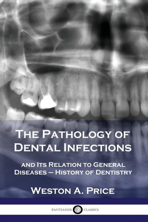 Kniha Pathology of Dental Infections 