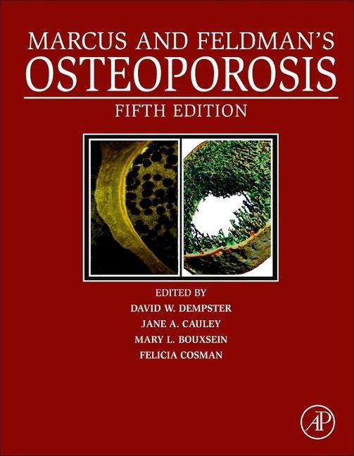 Книга Marcus and Feldman's Osteoporosis David W. Dempster