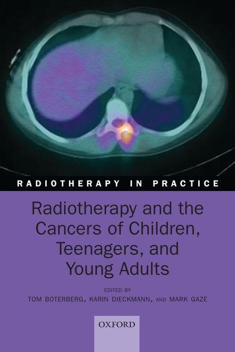 Carte Radiotherapy and the Cancers of Children, Teenagers, and Young Adults 