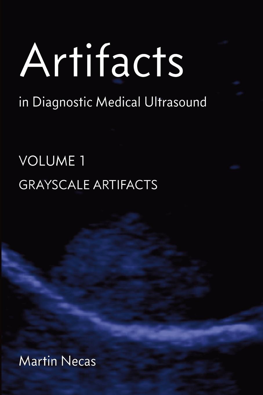 Kniha Artifacts in Diagnostic Medical Ultrasound 