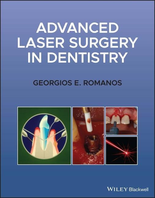 Książka Advanced Laser Surgery in Dentistry Georgios E. Romanos