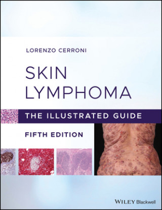 Книга Skin Lymphoma 
